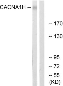 Western blot analysis of lysates from A549 cells using Anti-CACNA1H Antibody. The right hand lane represents a negative control, where the antibody is blocked by the immunising peptide