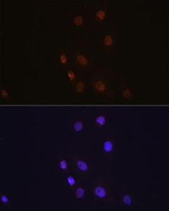 Immunofluorescence analysis of C6 cells using Anti-S100A4 Antibody [ARC0475] (A305282) at a dilution of 1:100 (40X lens). DAPI was used to stain the cell nuclei (blue)