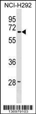 Anti-LMBR1 Rabbit Polyclonal Antibody (AP (Alkaline Phosphatase))