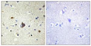 Immunohistochemical analysis of paraffin-embedded human brain tissue using Anti-Collagen IV alpha3 Antibody. The right hand panel represents a negative control, where the antibody was pre-incubated with the immunising peptide.