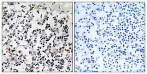 Immunohistochemical analysis of paraffin-embedded human lymph node tissue using Anti-CLIC4 Antibody. The right hand panel represents a negative control, where the antibody was pre-incubated with the immunising peptide