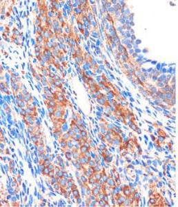 Immunohistochemistry analysis of paraffin-embedded rat ovary using Anti-ZPBP Antibody (A306207) at a dilution of 1:100 (40x lens). Perform microwave antigen retrieval with 10 mM PBS buffer pH 7.2 before commencing with IHC staining protocol.