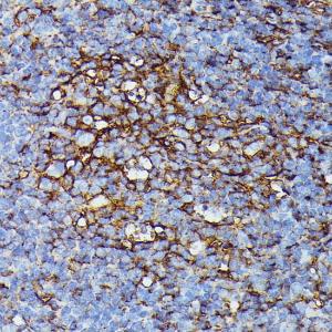 Anti-HLA Class 1 ABC Rabbit Polyclonal Antibody