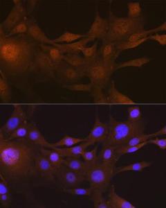 Immunofluorescence analysis of NIH-3T3 cells using Anti-S100A4 Antibody [ARC0475] (A305282) at a dilution of 1:100 (40X lens). DAPI was used to stain the cell nuclei (blue)