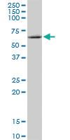 Anti-MMP19 Mouse Polyclonal Antibody