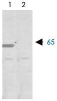 Anti-MMP8 Rabbit Polyclonal Antibody