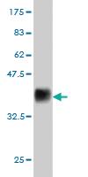 Anti-ESM1 Mouse Monoclonal Antibody [clone: 6D4]