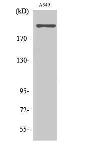 Western blot analysis of various cells using Anti-CACNA1H Antibody