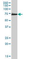 Anti-CAMKK1 Mouse Polyclonal Antibody