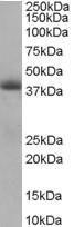 Anti-TIMM50 Antibody (A83405) staining (0.5µg/ml) of Human Heart lysate (RIPA buffer, 35µg total protein per lane). Primary incubated for 1 hour. Detected by chemiluminescence.