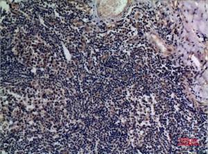 Immunohistochemical analysis of paraffin-embedded human tonsils using Anti-TNFSF13B Antibody