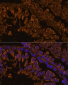 Immunofluorescence analysis of rat testis using Anti-ZPBP Antibody (A306207) at a dilution of 1:100. DAPI was used to stain the cell nuclei (blue).