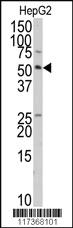 Anti-AXIN1 Rabbit Polyclonal Antibody