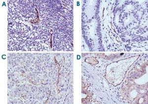 Anti-NOS3 Mouse Monoclonal Antibody [clone: 6H2]