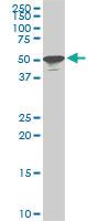 Anti-STK38 Mouse Monoclonal Antibody [clone: 6G11]