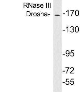 Western blot analysis of lysates from brain tissue using Anti-RNase III Drosha Antibody