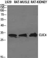 Western blot analysis of various cells using Anti-CLIC4 Antibody