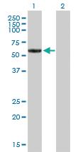 Anti-MMP19 Mouse Polyclonal Antibody