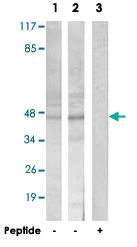 Anti-ARRDC3 Rabbit Polyclonal Antibody