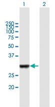 Anti-IRAK1BP1 Mouse Polyclonal Antibody