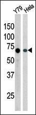 Anti-RAD9A Rabbit Polyclonal Antibody (HRP (Horseradish Peroxidase))