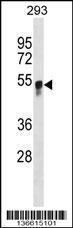 Anti-GCNT3 Rabbit Polyclonal Antibody (AP (Alkaline Phosphatase))