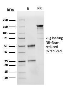 SDS-PAGE analysis of Anti-CD31 Antibody [PECAM1/3525] under non-reduced and reduced conditions; showing intact IgG and intact heavy and light chains, respectively. SDS-PAGE analysis confirms the integrity and purity of the antibody