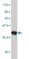 Anti-TXLNG2P Mouse Monoclonal Antibody [clone: 2F5]