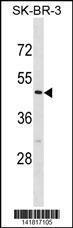 Anti-CASQ2 Rabbit Polyclonal Antibody (HRP (Horseradish Peroxidase))