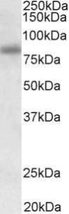 Anti-SDCCAG8 Antibody (A85034) (0.3µg/ml) staining of HEK293 lysate (35µg protein in RIPA buffer). Primary incubation was 1 hour. Detected by chemiluminescence.