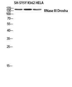 Western blot analysis of SH SY5Y K562 HELA using Anti-RNase III Drosha Antibody