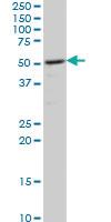 Anti-CAMK2D Mouse Monoclonal Antibody [clone: 1A8]