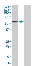 Anti-ALDH6A1 Mouse Polyclonal Antibody