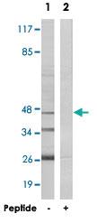 Anti-ARRDC4 Rabbit Polyclonal Antibody