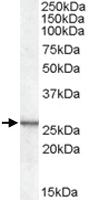 Anti-CSRP2 Goat Polyclonal Antibody