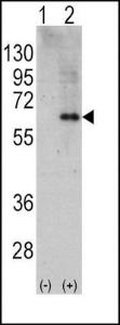 Anti-PRKAA2 Rabbit Polyclonal Antibody