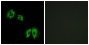 Immunofluorescence analysis of A549 cells using Anti-B3GALT2 Antibody. The right hand panel represents a negative control, where the antibody was pre-incubated with the immunising peptide