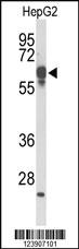 Anti-KCNA3 Rabbit Polyclonal Antibody