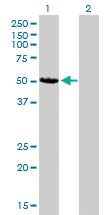 Anti-CAMK2D Mouse Monoclonal Antibody [clone: 1A8]