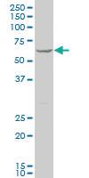 Anti-DCP1A Mouse Polyclonal Antibody