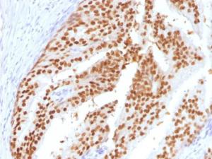 Immunohistochemical analysis of formalin-fixed, paraffin-embedded human prostate using Anti-FOXA1 Antibody [FOXA1/1516]