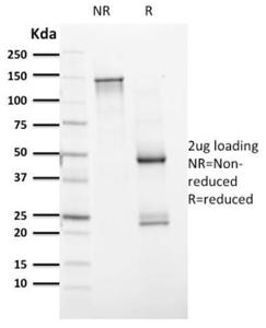 SDS-PAGE analysis of Anti-PAX8 Antibody [PAX8/1491] under non-reduced and reduced conditions; showing intact IgG and intact heavy and light chains, respectively. SDS-PAGE analysis confirms the integrity and purity of the antibody