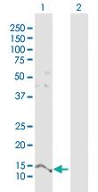 Anti-PTMS Rabbit Polyclonal Antibody