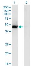 Anti-NR1H3 Mouse Monoclonal Antibody [clone: 3E9]