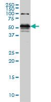 Anti-STK38 Mouse Monoclonal Antibody [clone: 6G11]