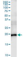 Anti-ESM1 Polyclonal Antibody Pair