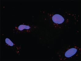 Anti-TP53 + PPP2R1A Antibody Pair