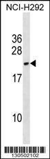 Anti-DYDC2 Rabbit Polyclonal Antibody (AP (Alkaline Phosphatase))