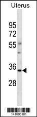 Anti-OR6S1 Rabbit Polyclonal Antibody (APC (Allophycocyanin))