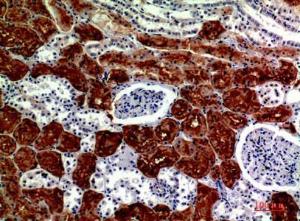 Immunohistochemical analysis of paraffin-embedded human kidney using Anti-RNase III Drosha Antibody